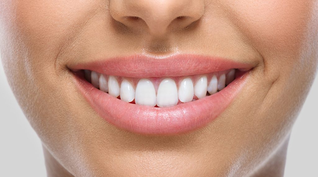 Estética dental en Castelldefels