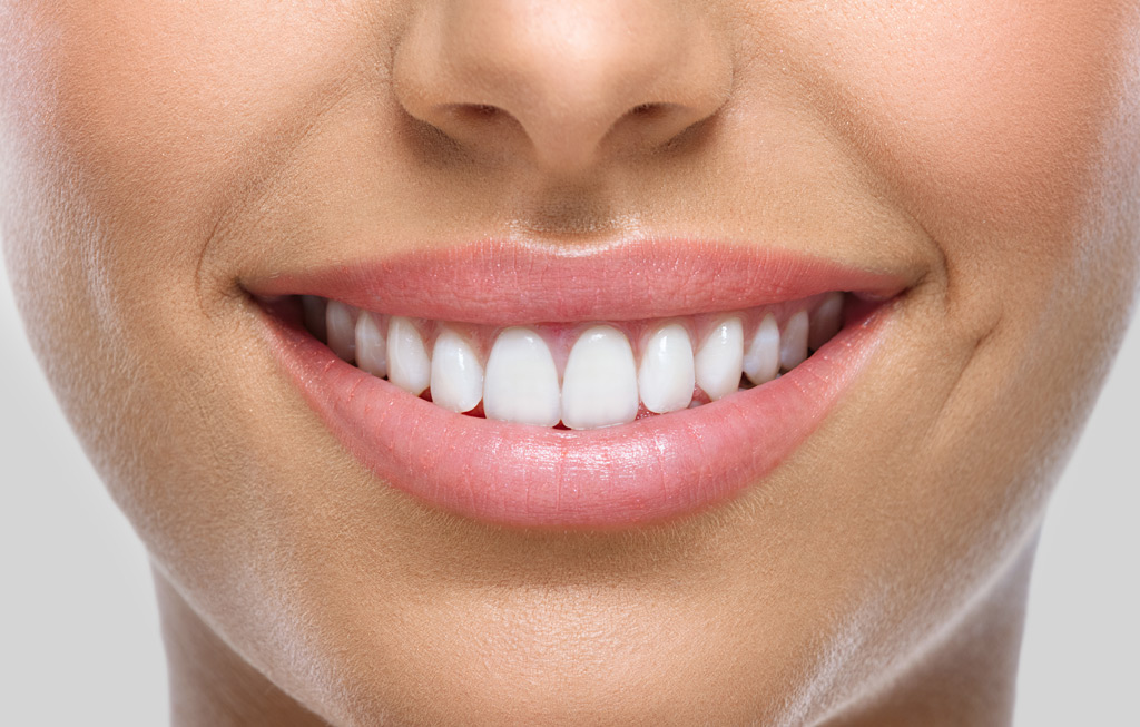 Estética dental en Castelldefels